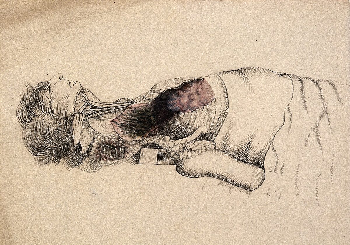Illustration for An Autopsy on the Man of the Shroud