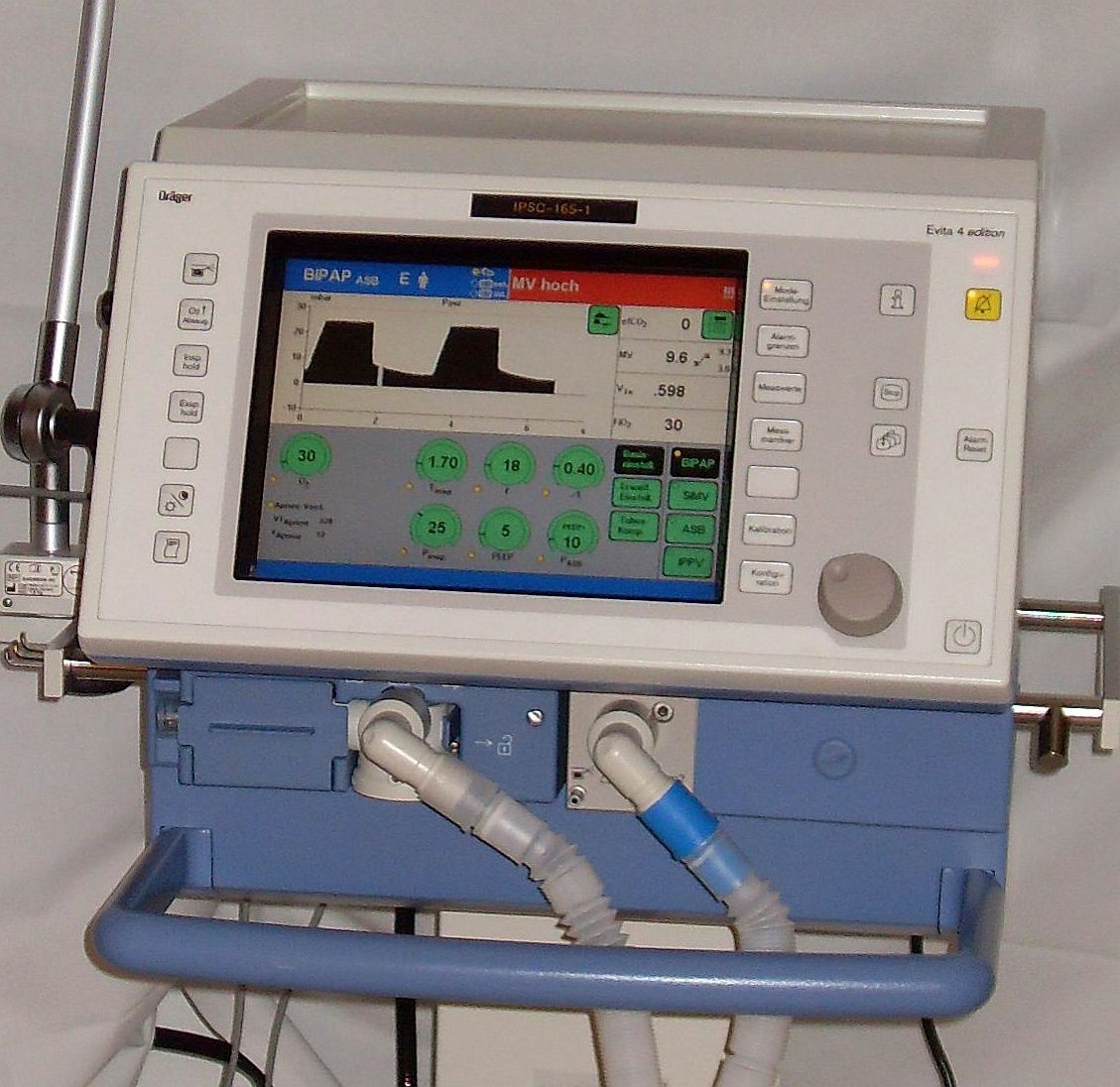 An intensive-care ventilator, its screen showing breathing waveforms and settings.